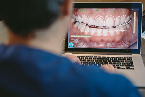 le dr hervé touati dessinne le nouveau sourire d'un patient avec le logiciel digital smile design